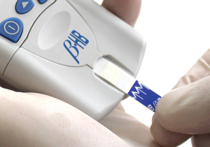 STAT-Site-M-BHB-Analyzer-1-step