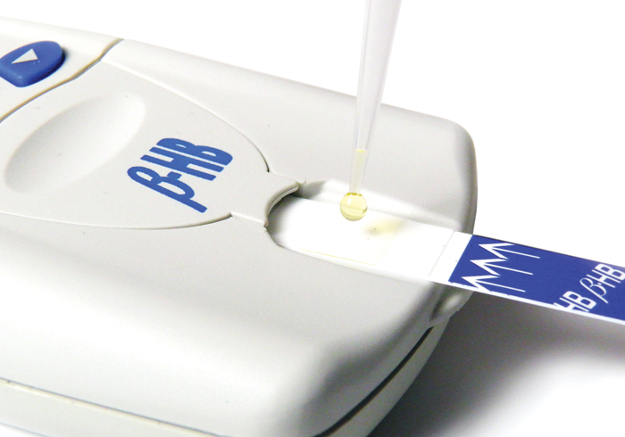STAT-Site-M-BHB-Analyzer-2-step